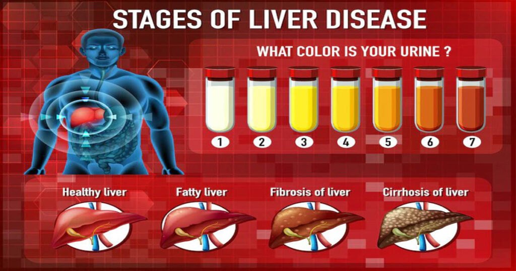 How To Prevent 8 Things That Can Damage Your Liver And Keep You Healthy ...