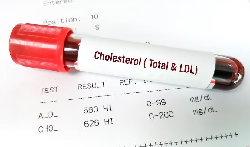 Cholesterol Screening